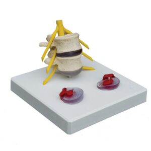 Pathology - Model