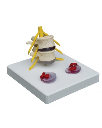Pathology - Model