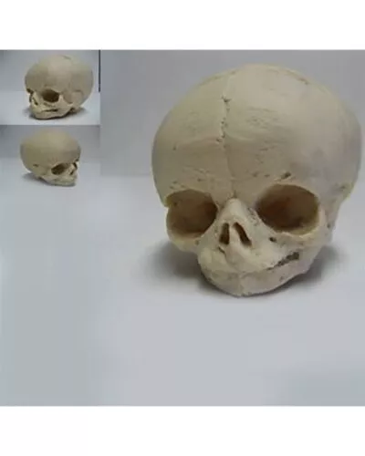 Human Skull Fetal