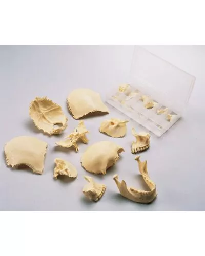 Disarticulated Skull