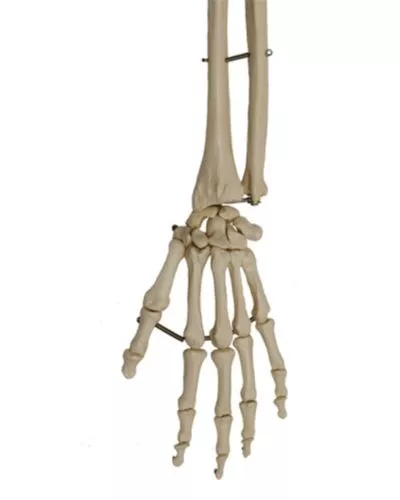 Hand Skeleton with Portion of Radius and Ulna