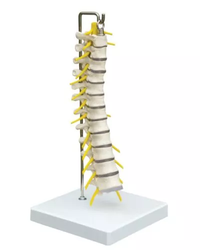 Lumbar Vertebrae