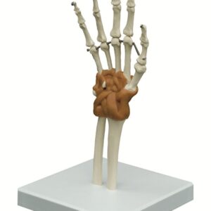 Wrist Joint with Ligaments