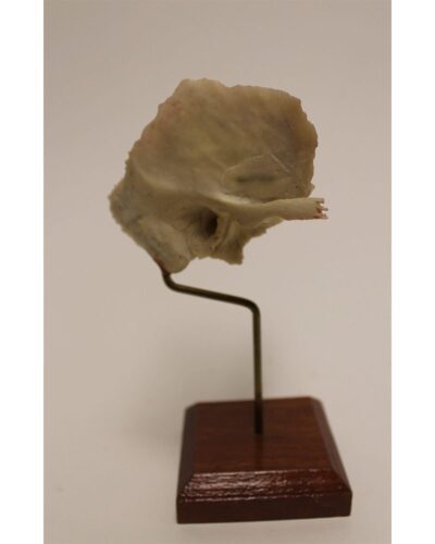 Temporal Bone on Stand