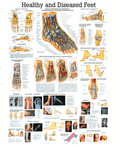 Healthy and Diseased Feet Anatomical Chart
