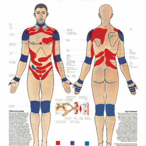Physiotherapy II Thermotherapy - Kryotherapy Anatomical Chart