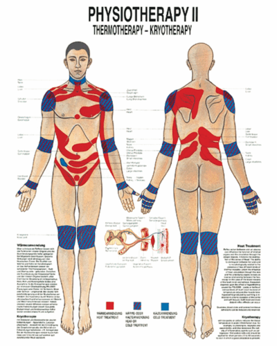 Physiotherapy II Thermotherapy - Kryotherapy Anatomical Chart
