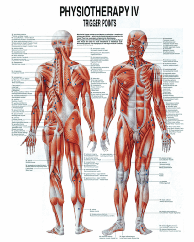 Physiotherapy IV Trigger Points Anatomical Chart