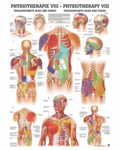 Physiotherapy VIII Triggerpoints Head and Torso Anatomical Chart