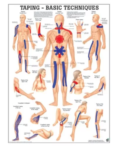 Taping - Basic Techniques Anatomical Chart