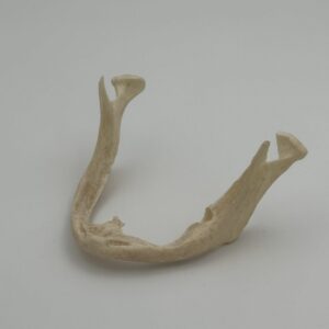 Edentulous Mandible