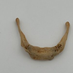 Hyoid