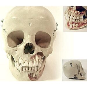 Real Human Child Skull Dental Model