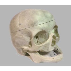 Real Human Geriatric Skull