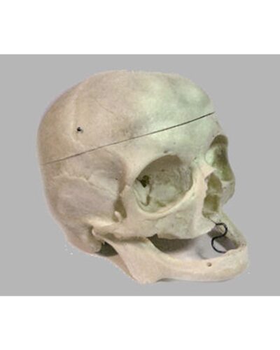 Real Human Geriatric Skull