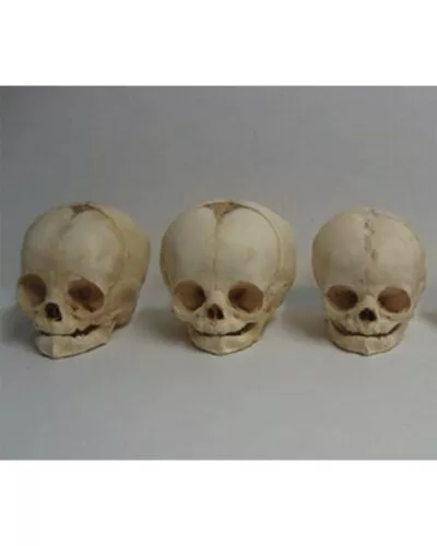 Real Human Fetal Skull