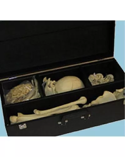 Skeleton Carrying Case