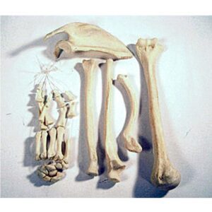 Upper Extremity
