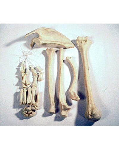 Upper Extremity