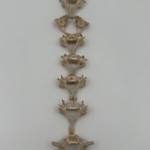 7 Cervical Vertebrae