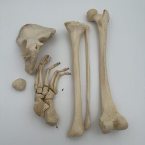 Lower Extremity