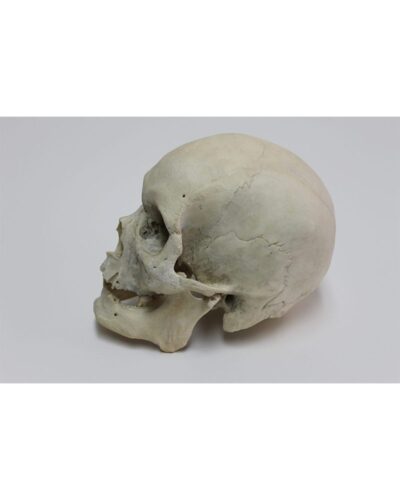 Real Human Skull 0-2 Teeth Very Minor Damage