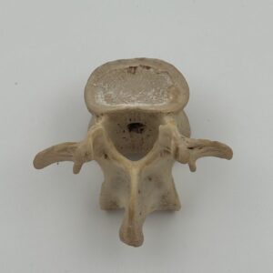Lumbar vertebrae