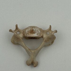 Cervical vertebrae