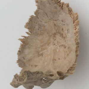 Occipital
