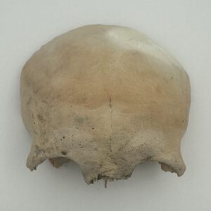 Frontal