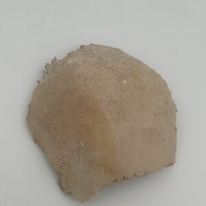 Parietal