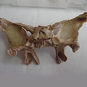 Sphenoid