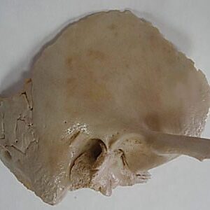 Temporal bone