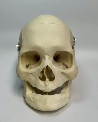 Edentulous Skull