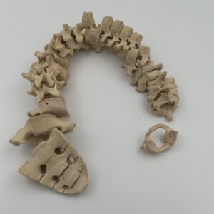 Human Adolescent Spine