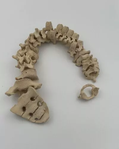Human Adolescent Spine