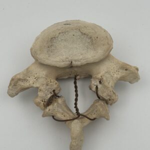 Human Lumbar Vertebrae