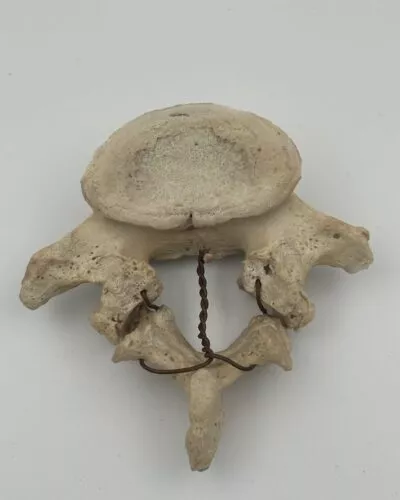 Human Lumbar Vertebrae