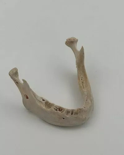 Mandible