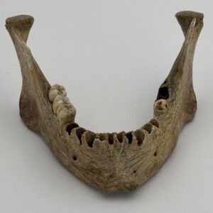 Mandible