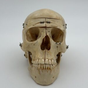 Human Skull