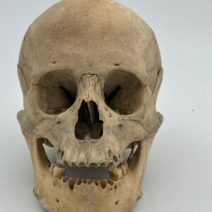Human Skull