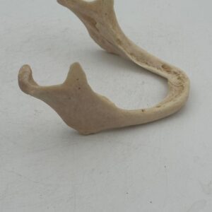 Edentulous Mandible