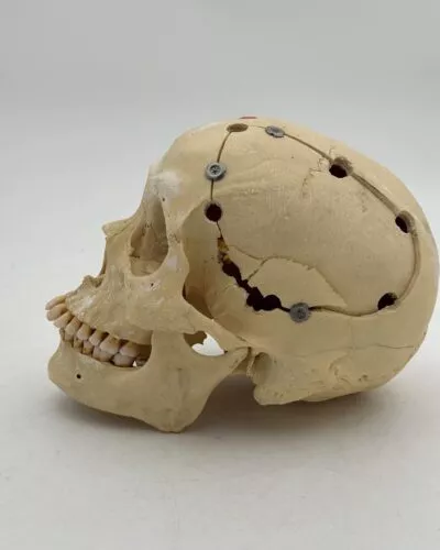 Human Skull