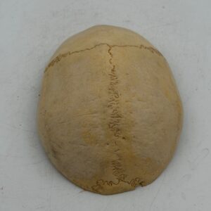 Human Skull calvarium Cap