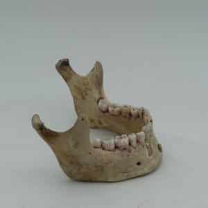 Human Mandible