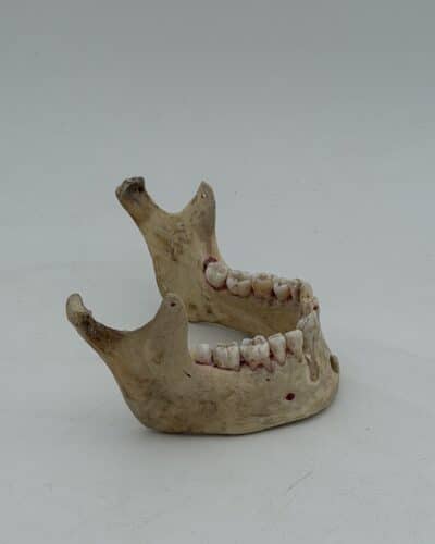 Human Mandible